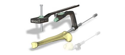 Sanatmetal Kft. - Magic Tibia Nailing System